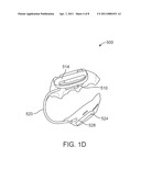 INTRAORAL APPLIANCE FOR SOUND TRANSMISSION VIA BONE CONDUCTION diagram and image