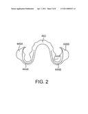 INTRAORAL APPLIANCE FOR SOUND TRANSMISSION VIA BONE CONDUCTION diagram and image