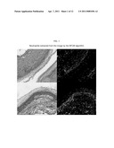 AUTOMATED PLACENTAL MEASUREMENT diagram and image