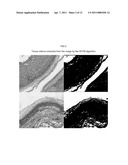 AUTOMATED PLACENTAL MEASUREMENT diagram and image