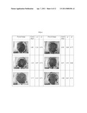 AUTOMATED PLACENTAL MEASUREMENT diagram and image