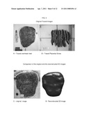 AUTOMATED PLACENTAL MEASUREMENT diagram and image