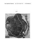 AUTOMATED PLACENTAL MEASUREMENT diagram and image