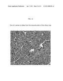 AUTOMATED PLACENTAL MEASUREMENT diagram and image