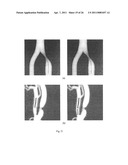 APPARATUS FOR STENOSIS ESTIMATION diagram and image