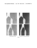 APPARATUS FOR STENOSIS ESTIMATION diagram and image