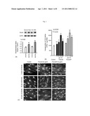 ELASTIN PRODUCING FIBROBLAST FORMULATIONS AND METHODS OF USING THE SAME diagram and image