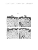 ELASTIN PRODUCING FIBROBLAST FORMULATIONS AND METHODS OF USING THE SAME diagram and image