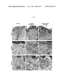 ELASTIN PRODUCING FIBROBLAST FORMULATIONS AND METHODS OF USING THE SAME diagram and image