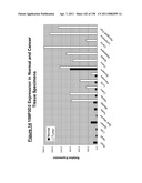 NUCLEIC ACIDS AND CORRESPONDING PROTEINS ENTITLED 158P3D2 USEFUL IN TREATMENT AND DETECTION OF CANCER diagram and image