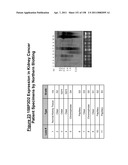 NUCLEIC ACIDS AND CORRESPONDING PROTEINS ENTITLED 158P3D2 USEFUL IN TREATMENT AND DETECTION OF CANCER diagram and image