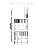 NUCLEIC ACIDS AND CORRESPONDING PROTEINS ENTITLED 158P3D2 USEFUL IN TREATMENT AND DETECTION OF CANCER diagram and image