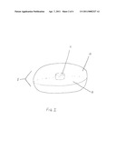 SALINE MEMBRANOUS COUPLING MECHANISM FOR ELECTROMAGNETIC AND PIEZOELECTRIC ROUND WINDOW DIRECT DRIVE SYSTEMS FOR HEARING AMPLIFICATION diagram and image