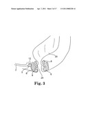 METHODS FOR INSTALLING SLING TO TREAT FECAL INCONTINENCE, AND RELATED DEVICES diagram and image