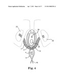 METHODS FOR INSTALLING SLING TO TREAT FECAL INCONTINENCE, AND RELATED DEVICES diagram and image