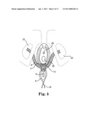 METHODS FOR INSTALLING SLING TO TREAT FECAL INCONTINENCE, AND RELATED DEVICES diagram and image