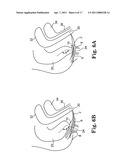 METHODS FOR INSTALLING SLING TO TREAT FECAL INCONTINENCE, AND RELATED DEVICES diagram and image