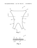 METHOD OF IMPLANTING A FABRIC TO REPAIR A PELVIC FLOOR diagram and image