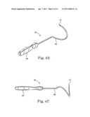 MINIMALLY INVASIVE LEVATOR AVULSION REPAIR diagram and image