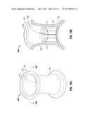 UNIVERSAL HEIGHT FOAM PORT diagram and image