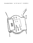 PHOTOPLETHYSMOGRAPHY DEVICE AND METHOD diagram and image