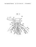 METHOD AND SYSTEM FOR DETECTING ELECTROPHYSIOLOGICAL CHANGES IN PRE-CANCEROUS AND CANCEROUS TISSUE AND EPITHELIUM diagram and image