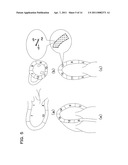 MEDICAL IMAGE PROCESSING DEVICE AND MEDICAL IMAGE PROCESSING METHOD diagram and image