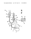 Bymixer Apparatus and Method for Fast-Response, Adjustable Measurement of Mixed Gas Fractions in Ventilation Circuits diagram and image