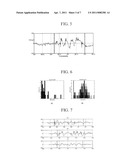 Time Frequency Transformation Analysis for Detection and Quantification of Epileptiform Activity Load in Generalized Epilepsies diagram and image