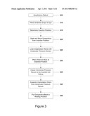 METHOD FOR IMPLANTING INTRAOCULAR PRESSURE SENSOR diagram and image