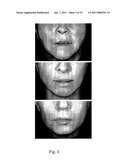 METHODS FOR MEASURING CHANGE IN LIP SIZE AFTER AUGMENTATION diagram and image