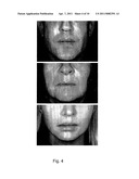 METHODS FOR MEASURING CHANGE IN LIP SIZE AFTER AUGMENTATION diagram and image