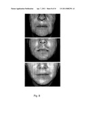 METHODS FOR MEASURING CHANGE IN LIP SIZE AFTER AUGMENTATION diagram and image