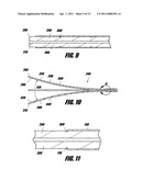 LUMEN-MEASURING DEVICES AND METHOD diagram and image