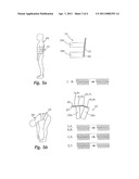 ORTHOPEDIC ORTHOSIS diagram and image