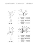 ORTHOPEDIC ORTHOSIS diagram and image