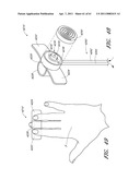 DEVICES, SYSTEMS AND METHODS FOR TREATING THE SKIN USING TIME-RELEASE SUBSTANCES diagram and image