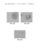 BIORESORBABLE EMBOLIZATION MICROSPHERES diagram and image