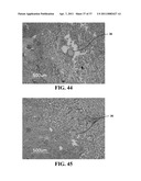 BIORESORBABLE EMBOLIZATION MICROSPHERES diagram and image