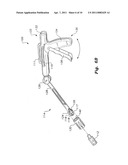 BIOINJECTION DEVICE diagram and image