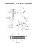 CARDIAC ABLATION SYSTEM WITH PULSED AIMING LIGHT diagram and image