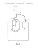 Cryosurgical System diagram and image