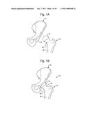SURGICAL SYSTEM FOR POSITIONING PROSTHETIC COMPONENT AND/OR FOR CONSTRAINING MOVEMENT OF SURGICAL TOOL diagram and image