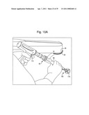 SURGICAL SYSTEM FOR POSITIONING PROSTHETIC COMPONENT AND/OR FOR CONSTRAINING MOVEMENT OF SURGICAL TOOL diagram and image