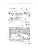 MEDICAL DEVICE diagram and image