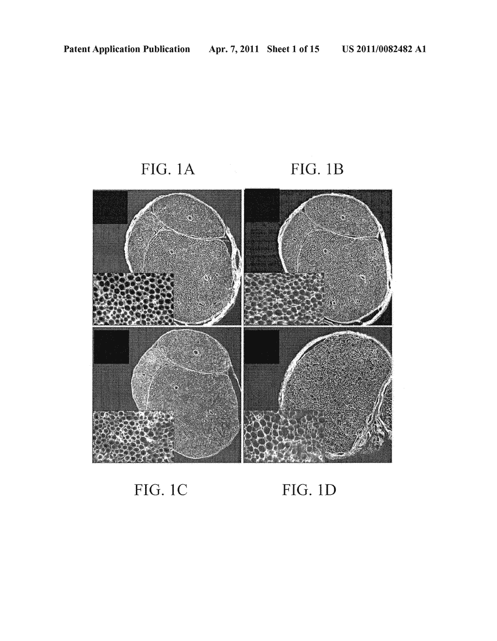 Materials and Methods for Nerve Repair - diagram, schematic, and image 02