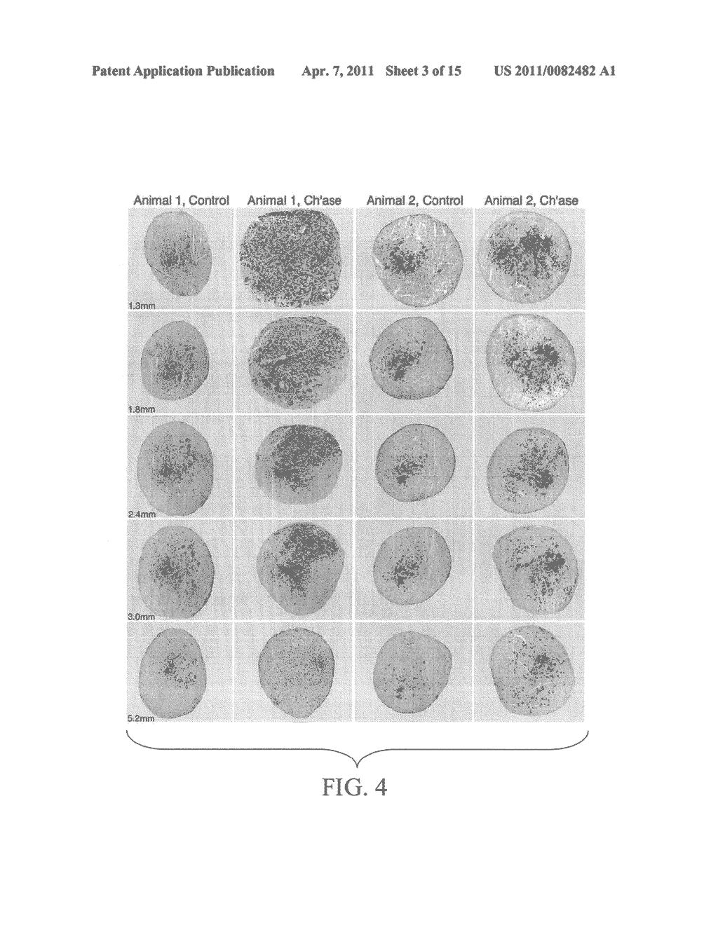 Materials and Methods for Nerve Repair - diagram, schematic, and image 04