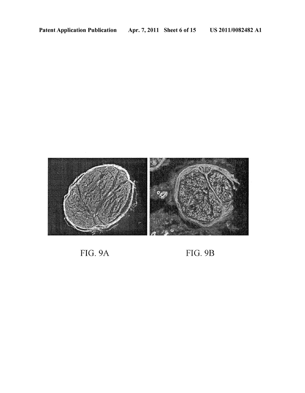 Materials and Methods for Nerve Repair - diagram, schematic, and image 07