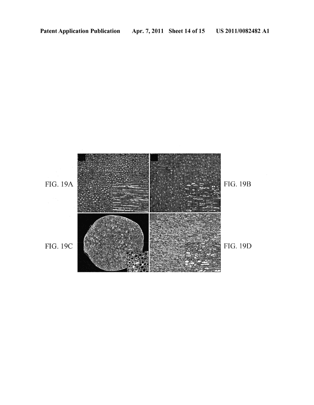 Materials and Methods for Nerve Repair - diagram, schematic, and image 15