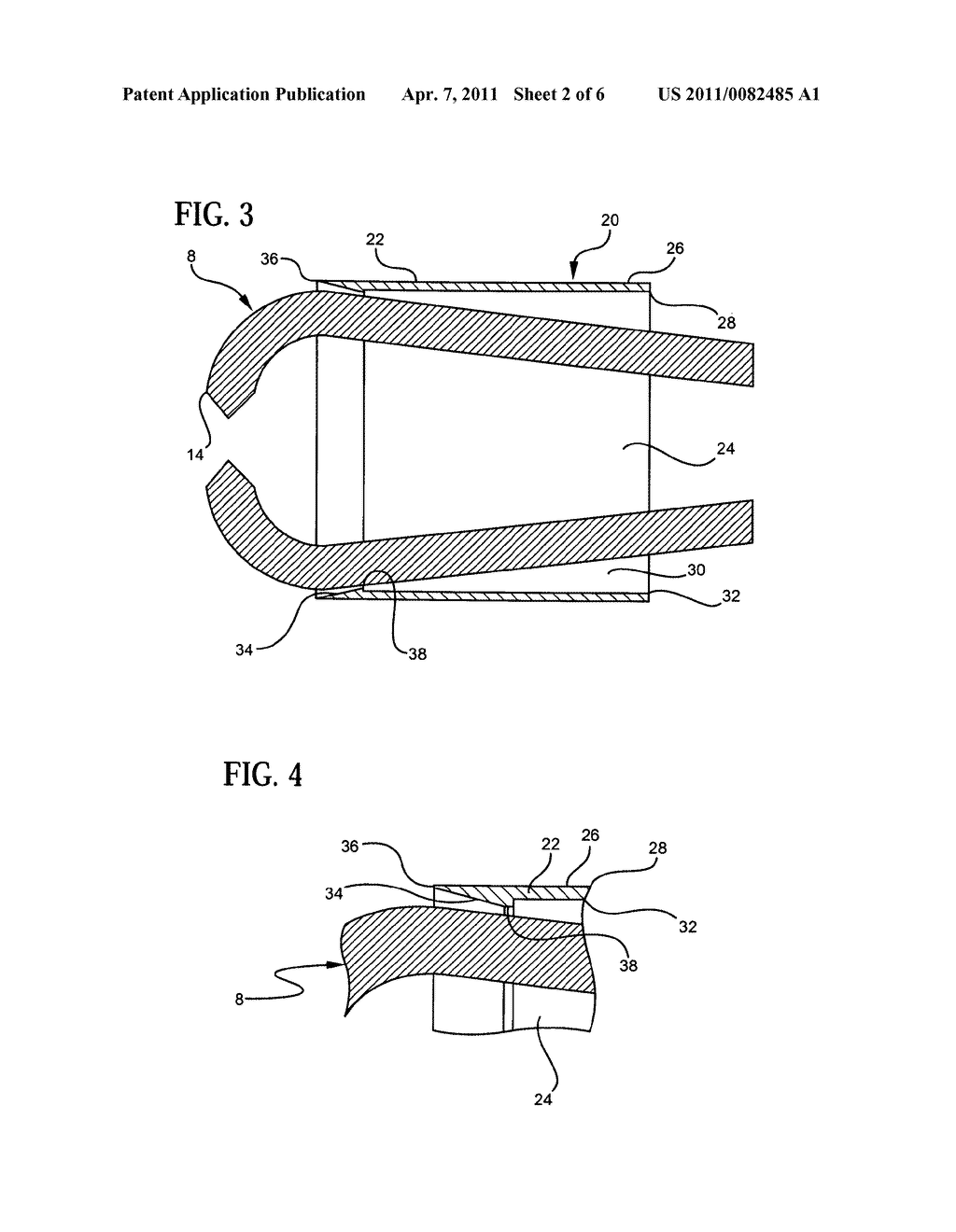 CUTTING BLADE FOR MORCELLATOR - diagram, schematic, and image 03